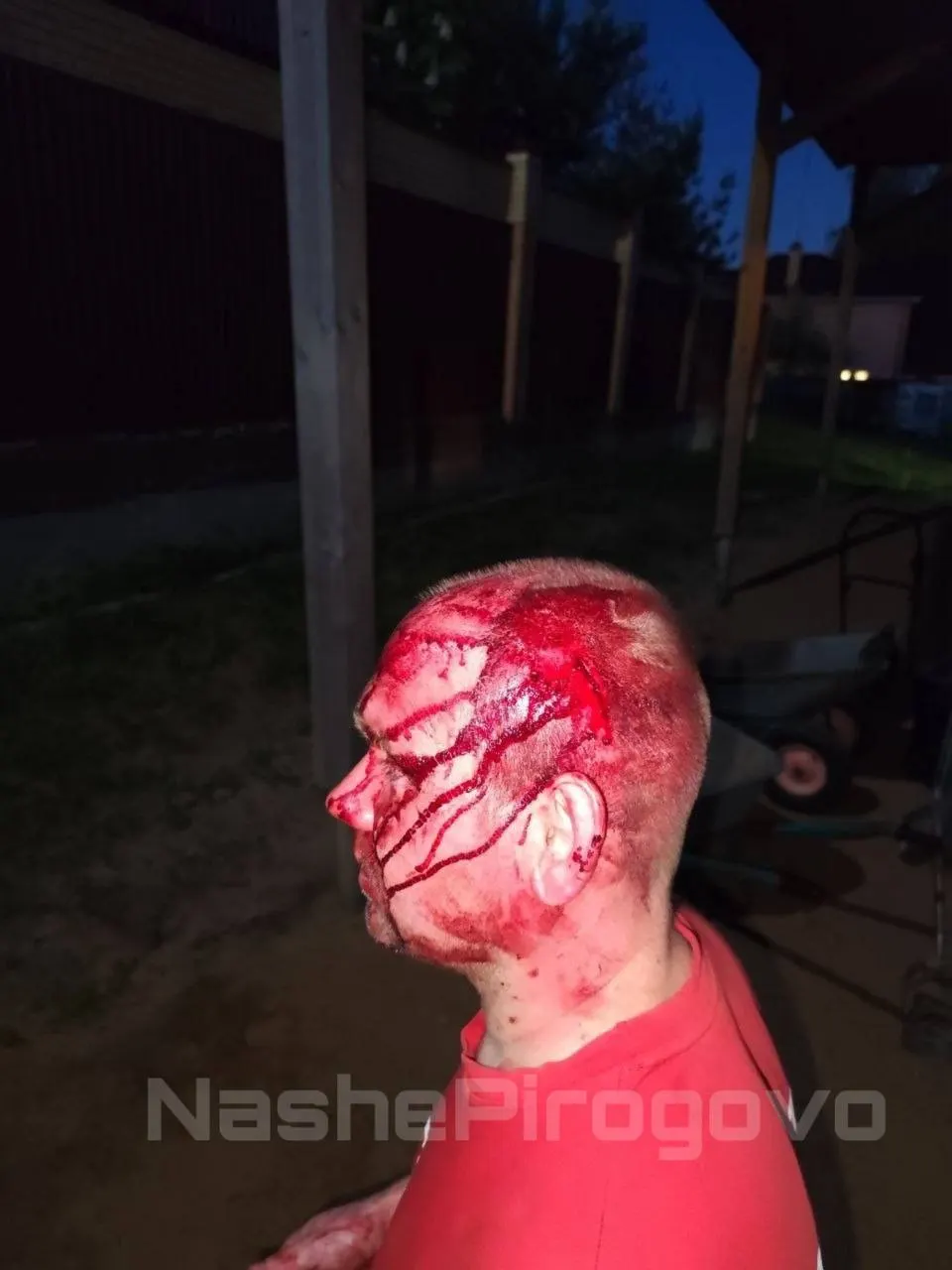 В деревне Пирогово директор местного завода ворвался на частную территорию активиста с вилами, избил его и убил сторожевую собаку — жители требуют наказать нападавшего.