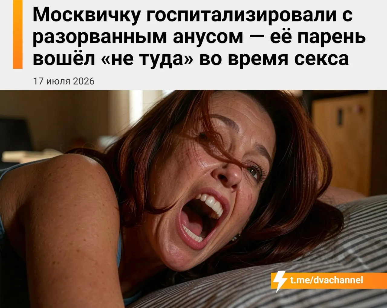 20-летней девушке потребовалась срочная операция после травмы аноректальной области в результате неосторожного полового акта — её состояние стабилизировано, но предстоит длительное восстановление.