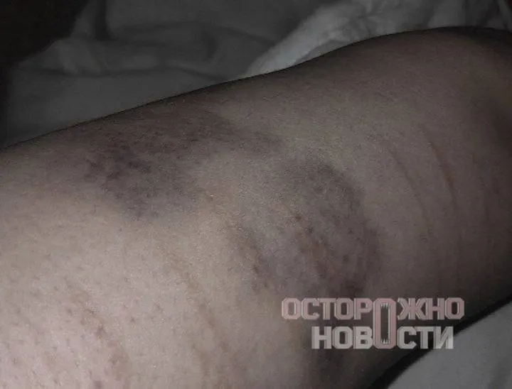 Один из людей, находившихся в автозаке вместе со стримером, утверждает, что сотрудник ОМОНа избивал задержанных, применял электрошокер и оскорблял их. Некоторых держали в отделе несколько часов, а затем отпустили без предъявления обвинений.